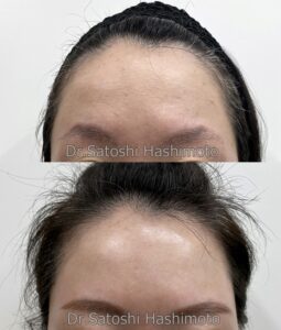 美容皮膚科学会にてスネコス Sunekos の講演 スキンフィニティクリニック