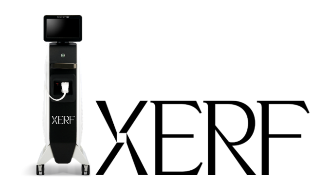 XERF（ザーフ）